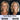 NeckDefine | Tighten & Lift Neck Cream